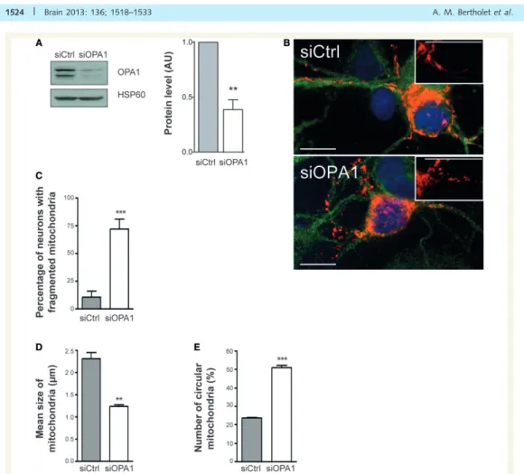Figure 3 Effect of OPA1 downregulation on mitochondrial morphology. (A) Representative immunoblots (left) and histograms (right)