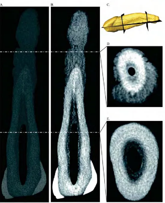 Figure 1. Visualization of hypercementosis and secondary dentine on the root of the  Neanderthal maxillary canine BD15 (Abri Bourgeois-Delaunay, France)