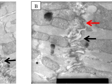 Figure 5 : Aspect ultrastructural du disque intercalaire normal 