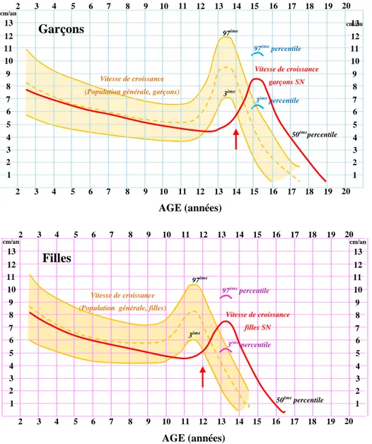 Figure 5 : Comparaison des vitesses de croissance des patients SN (en rouge) et de la population  générale (orange) (d’après la charte de croissance du syndrome de Noonan élaborée par Novo  Nordisk)
