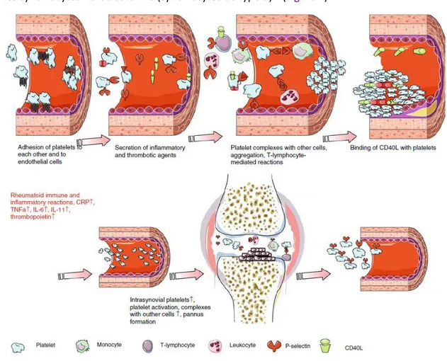 Figure 4 : Activation des plaquettes au cours de la PR 39