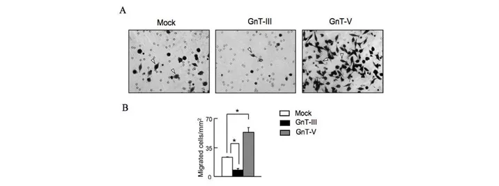 Figure  5 :  Effet  de  la  surexpression  des  GnT-III  et  GnT-V  sur  le  potentiel  migratoire  des 