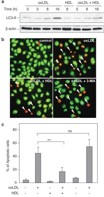 Figure 4 HDLs inhibit LC3 processing and cell death induced by oxLDLs in human macrophages