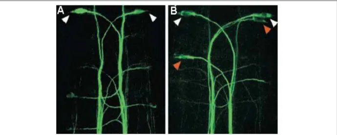 Fig. 13: Observation du neurone réticulo-spinal de Mauthner localisé de part et d’autre de l’axe médian dans des 