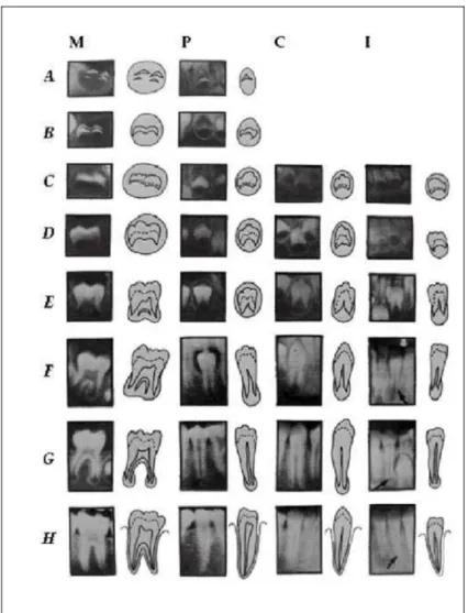 Figure 5. Représentation des différents stades radiographiques en fonction du type de dent   permanente (Demirjian et al., 1973) 