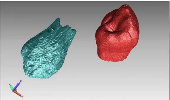 Figure 24. Visualisation des reconstructions tridimensionnelles de la même dent  avec le logiciel  RapidForm (v