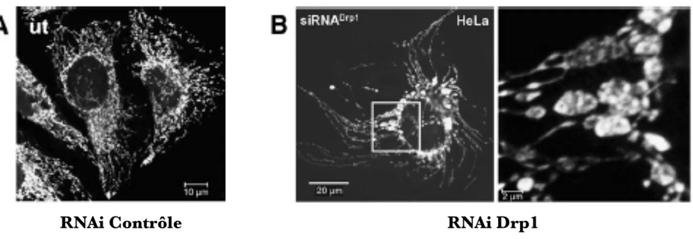 Figure n°20 : Effets de la déplétion en Drp1 dans des cellules HeLa. 