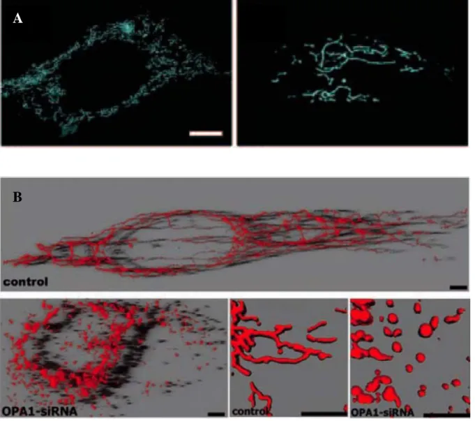 Figure  n°36 :  Effet  de  la  surexpression  et  de  l’extinction  d’OPA1  sur  la  morphologie  des  mitochondries