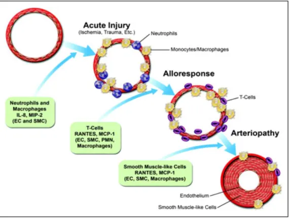 Figure 8 : Effet des chimiokines sur le développement de la vasculopathie de 