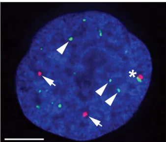 Figure  12 :  Observation  de  corpuscules  de  Cajal  (CB)  et  de  Promyelocytic  Leukaemia bodies (PML) dans des cellules humaines