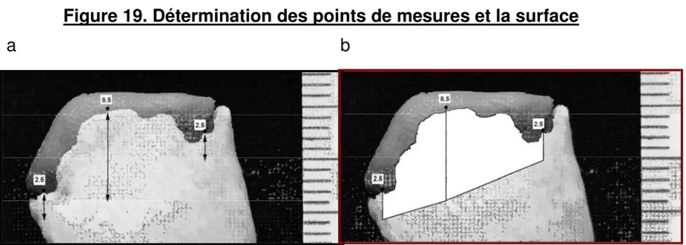 Figure 19. Détermination des points de mesures et la surface  