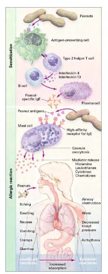 Figure 1 : mécanisme de la phase de sensibilisation et de la phase active de la  réaction allergique