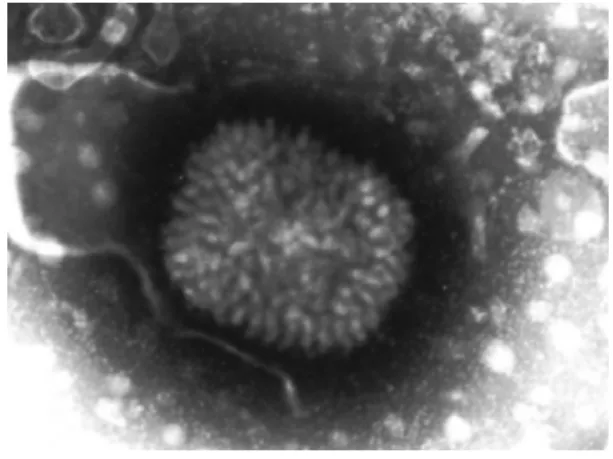 Figure 1 : Observation du MYXV en microscopie électronique à transmission. 