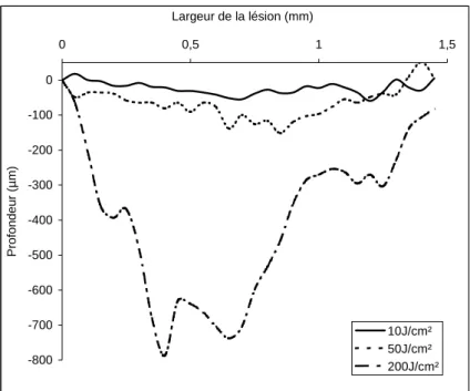 Figure 26: Profil moyen des lésions obtenues par utilisation des fluences 10, 50 et 200 J/cm²