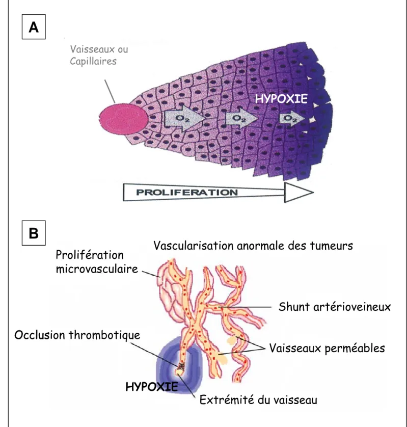 Figure 5 :  Origine de l’hypoxie au sein des tumeurs.  