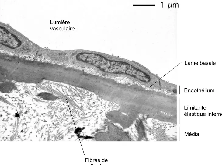 Figure 2 : Intima en microscopie électronique à transmission 