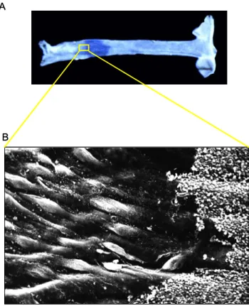 Figure 5 : Visualisation d’une zone de désendothélilisation 