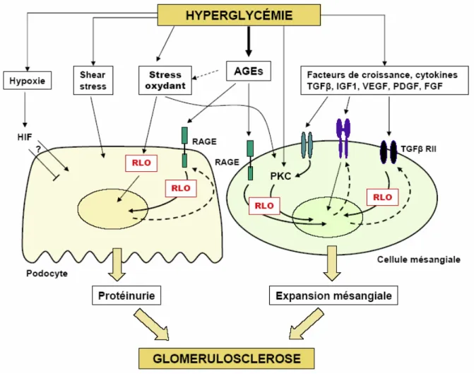 Figure 7 : Principaux mécanismes physiopathologiques impliqués dans le développement de  l’atteinte glomérulaire au cours de la néphropathie diabétique 