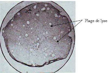 Figure  27 :  Culture  de  fibroblastes  de  canard  observée  à  3  jours  après  l’infection avec DEV (3/4x) (Jansen, 1971) 