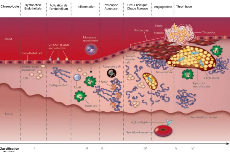 Figure 3: Etapes de la formation de la plaque d’athérome. Les LDL natives passent dans le 