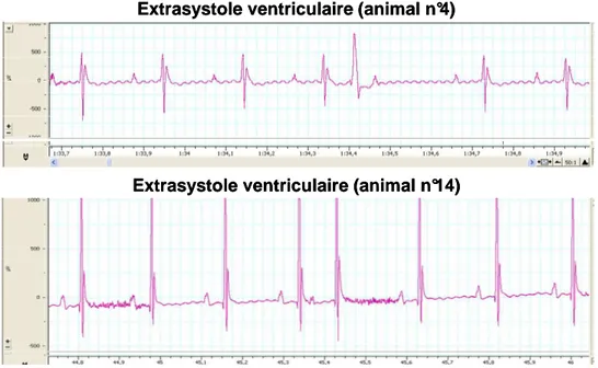 Figure 1.4 : Exemple chez deux souris d’un tracé électrocardiographique  témoignant de la présence de troubles du rythme ventriculaire à l’issue du 
