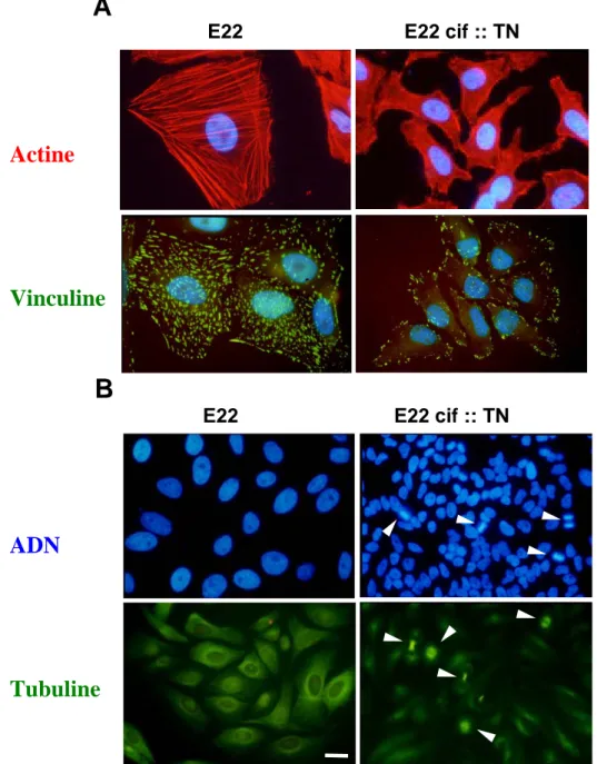 Figure 5: La protéine Cif modifie la physiologie des cellules eucaryotes. (A) A gauche, les  cellules ont été infectées avec une EPEC E22 qui produit Cif