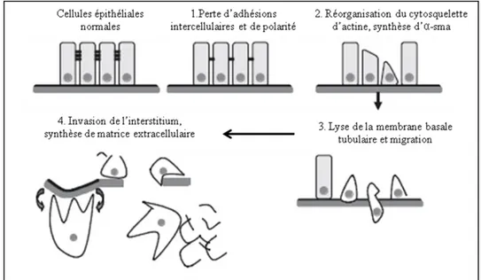 Figure 9: Les principales étapes de la transition épithélio-mésenchymateuse. 