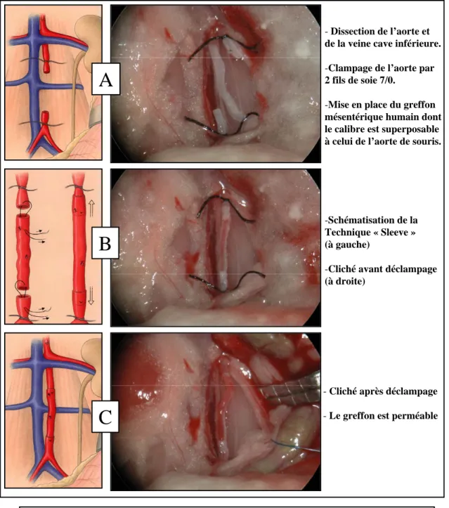 Figure 3 : Schémas et clichés per opératoires représentant la greffe d’une 