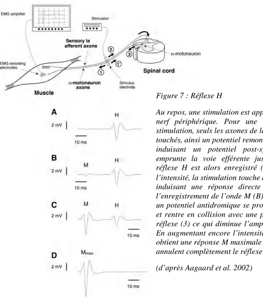 Figure 7 : Réflexe H 