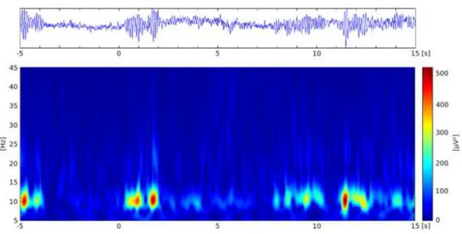 Figure  8 :  signal  EEG  brut  sur  la  ligne  du  haut  et  sa  représentation  temps-fréquence  après  transformation  en 