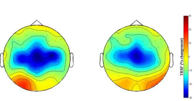 Figure 15 : représentation topographique de la distribution du TRSP EEG dans la bande de fréquence entre 13 et 