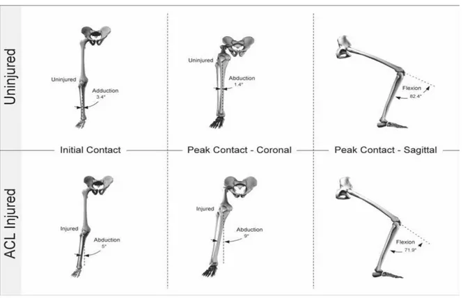 Figure 4. Modèle biomécanique représentant la cinématique articulaire du genou au cours 