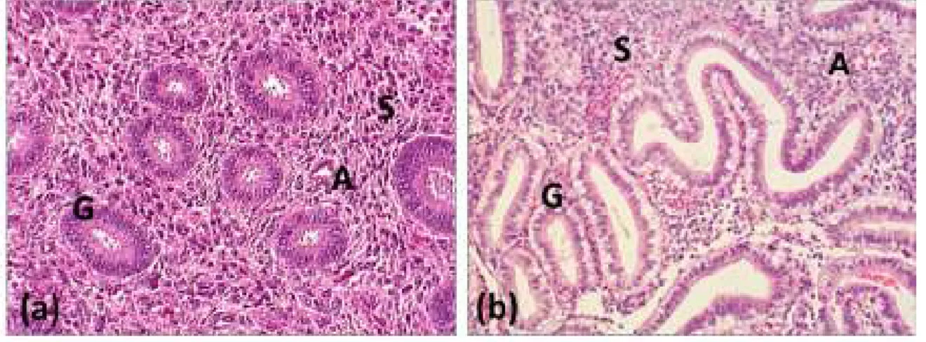 Figure 3: Histological slides of proliferative (a) and secretory (b) endometrium  Slides from paraffin embedded samples, Haematoxylin and Eosin Staining (x400) 