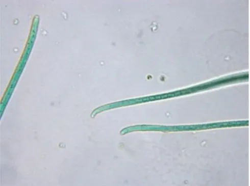 Figure 12. Micrographie de bactéries de la souche Oscillatoria  sp. PC 6506 cultivée au  laboratoire (grossissement ×400) 