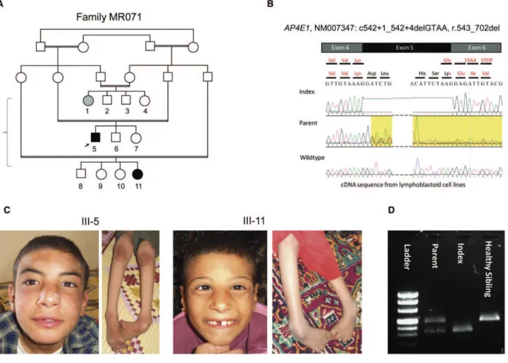 Figure 3. Genetic Analysis of Family MR071 (A) Pedigree of family MR071.