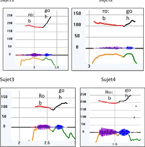 Figure 10 : Ton bas réalisé avec un contour plat sur la première syllabe 