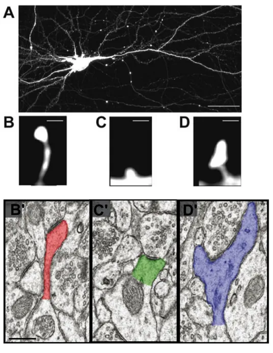 Figure 9 : Visualisation de la morphologie des épines  dendritiques dans un neurone pyramidal de la région CA3 de 