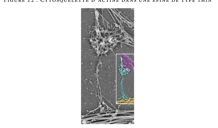 Figure 12 : Cytosquelette d’ actine dans une épine de type thin
