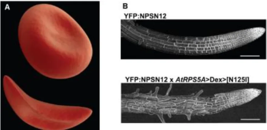 Figure  1.2.  Examples  of  cell  shape  degenerations.  (A)  An  erythrocyte  in  normal  shape  (top)  and  in  sickle  anemia  (bottom)