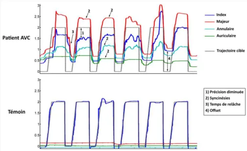 Figure 15 : Comparaisons de groupes entre les sujets témoins (carrés) et les patients AVC (cercles)