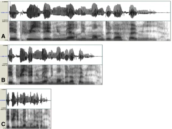 Figure 3.1: Waveforms and spectrograms of one sentence at its normal duration (A), compressed to 60% (B), and to 30% (C) of its original duration.