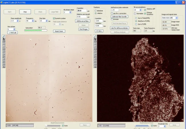 figure II.3: image acquisition graphical interface showing the tomographic image (on the right) and the   direct image (on the left)
