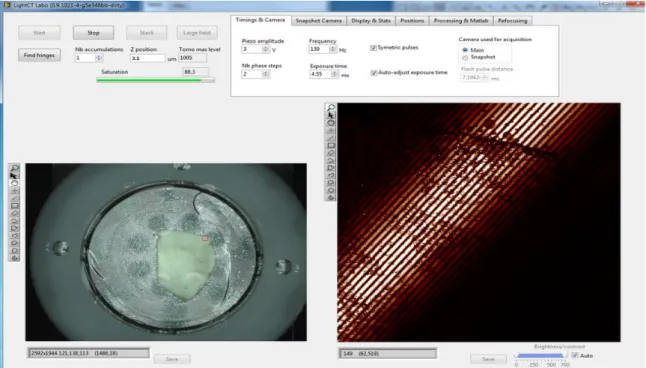 figure  II.7:   field   of   view   of   1x1   mm²   and   corresponding   tomographic   image   at   glass   slide-specimen   interface