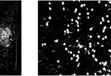 Figure 2.8 – Gauche : photographie des particules avec la pr´esence des polariseurs. Droite : zoom sur la partie centrale.