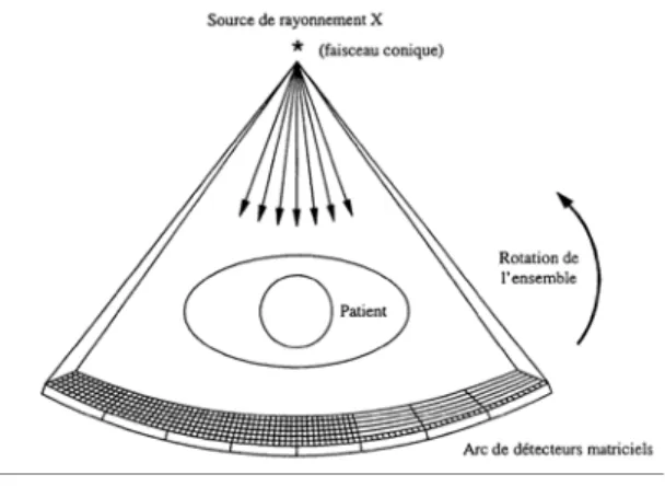 Fig. 1.6 – Tomographe multi coupes 