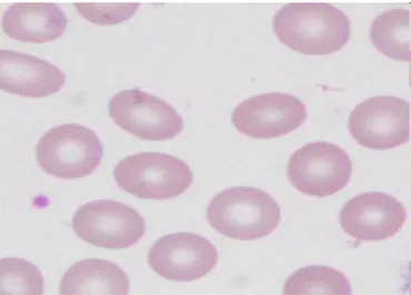Figure 2 : Aspect en microscopie électronique à balayage des globules rouges 