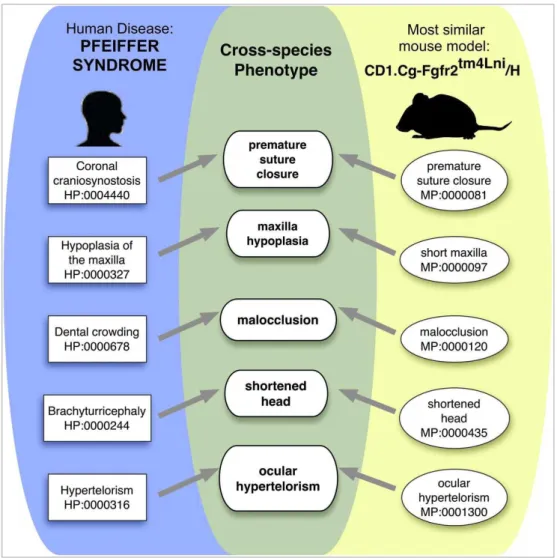 Figure 11: Exemple d’algorithme de similitudes phénotypiques dans la maladie  de Pfeiffer  (d’après Robinson et al, 2014).