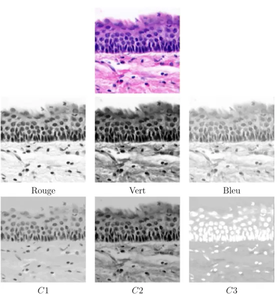 Figure 2.5 – Illustration des différents canaux couleurs RGB (deuxième ligne) et modèle de couleur invariant (troisième ligne) d’une image marquée par de l’hématoxyline et de l’éosine (en haut).