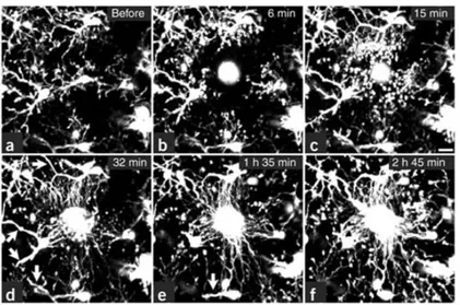 Figure 8: Mouvements rapides des prolongements microgliaux vers le site de lésion   (Davalos et al., 2005) 
