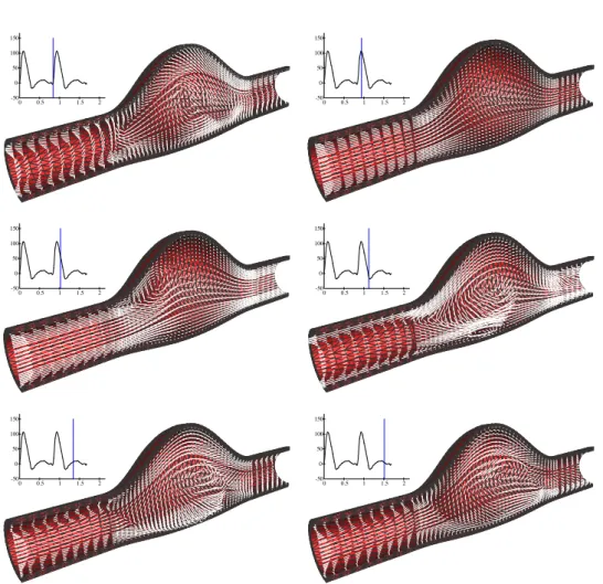 Figure 4.7: Robin based semi-implicit coupling: snapshots of the solid deformation and uid velocity eld at dierent time instants.